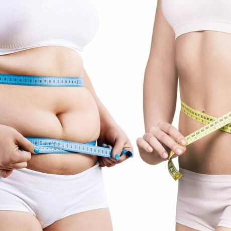 Fett reduzieren durch Fett-Weg-Spritze, Liposuktion und Hautstraffung