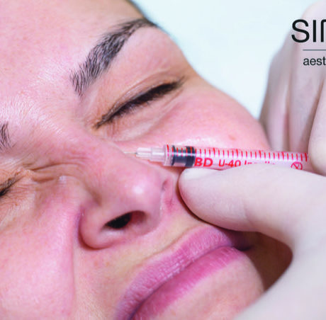 Offene oder geschlossene Nasenoperation? Nasenkorrektur bei Sinis Aesthetics